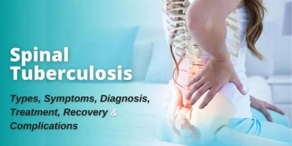Some of the Best Qualities of a Spinal Tuberculosis Specialist
